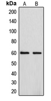 CYP4F2 Antibody - Western blot analysis of Cytochrome P450 4F2 expression in A549 (A); HepG2 (B) whole cell lysates.