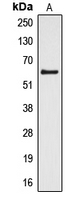 CYP4Z1 Antibody - Western blot analysis of Cytochrome P450 4Z1/2 expression in HL60 (A) whole cell lysates.