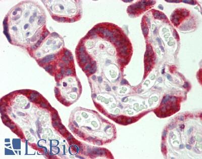 CYP8B1 Antibody - Human Placenta: Formalin-Fixed, Paraffin-Embedded (FFPE)