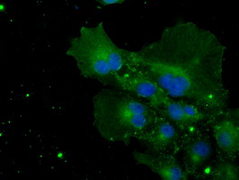 CYPOR / POR Antibody - Anti-POR mouse monoclonal antibody immunofluorescent staining of COS7 cells transiently transfected by pCMV6-ENTRY POR.