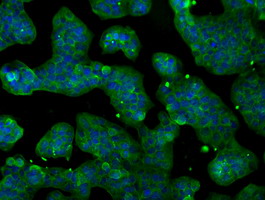 CYPOR / POR Antibody - Immunofluorescent staining of HeLa cells using anti-POR mouse monoclonal antibody.