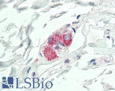 CYR61 Antibody - Human Colon, Submucosal Plexus: Formalin-Fixed, Paraffin-Embedded (FFPE)