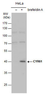 CYR61 Antibody - Un-treated (-) and treated (+, 1x Brefeldin A treatment for 24 hrs) HeLa whole cell extracts (30 µg) were separated by 10% SDS-PAGE, and the membrane was blotted with CYR61 antibody diluted by 1:1000.