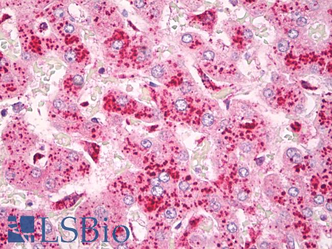 CYSLT2 / CYSLTR2 Antibody - Anti-CYSLT2 / CYSLTR2 antibody IHC of human liver, Kupffer cells. Immunohistochemistry of formalin-fixed, paraffin-embedded tissue after heat-induced antigen retrieval. Antibody dilution 5 ug/ml.