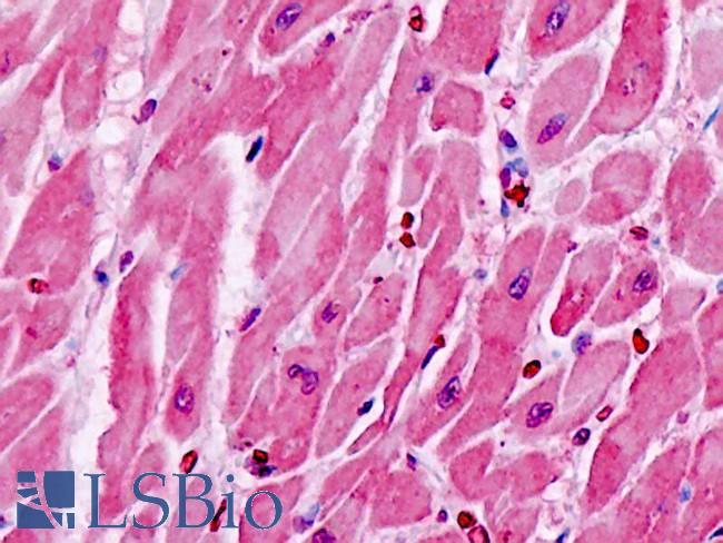 CYSLTR1 / CYSLT1 Antibody - Anti-CYSLTR1 / CYSLT1 antibody IHC staining of human heart. Immunohistochemistry of formalin-fixed, paraffin-embedded tissue after heat-induced antigen retrieval.