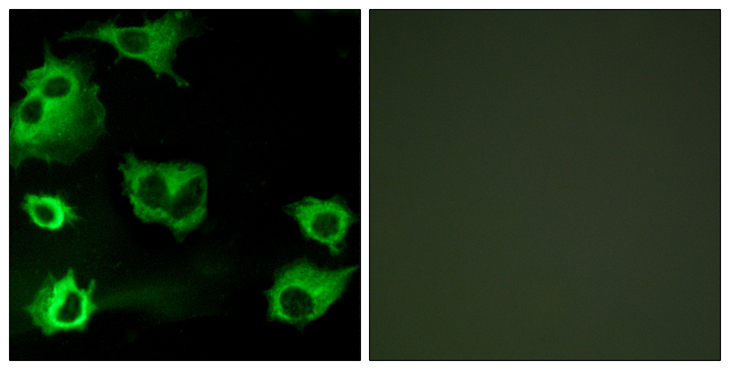 CYSLTR1 / CYSLT1 Antibody - Immunofluorescence analysis of COS7 cells, using CYSLTR1 Antibody. The picture on the right is blocked with the synthesized peptide.