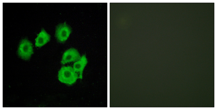 CYSLTR1 / CYSLT1 Antibody - Immunofluorescence analysis of HUVEC cells, using CLTR1 Antibody. The picture on the right is blocked with the synthesized peptide.