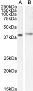 CYTIP Antibody - Goat Anti-CYBR / PSCDBP Antibody (0.5µg/ml) staining of Jurkat (A) and (1ug/ml) MOLT4 (B) cell lysate (35µg protein in RIPA buffer). Detected by chemiluminescencence.