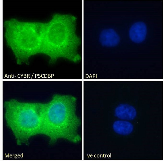 CYTIP Antibody - Goat Anti-CYBR / PSCDBP Antibody Immunofluorescence analysis of paraformaldehyde fixed A431 cells, permeabilized with 0.15% Triton. Primary incubation 1hr (10ug/ml) followed by Alexa Fluor 488 secondary antibody (2ug/ml), showing cytoplasmic and nuclear staining. The nuclear stain is DAPI (blue). Negative control: Unimmunized goat IgG (10ug/ml) followed by Alexa Fluor 488 secondary antibody (2ug/ml).