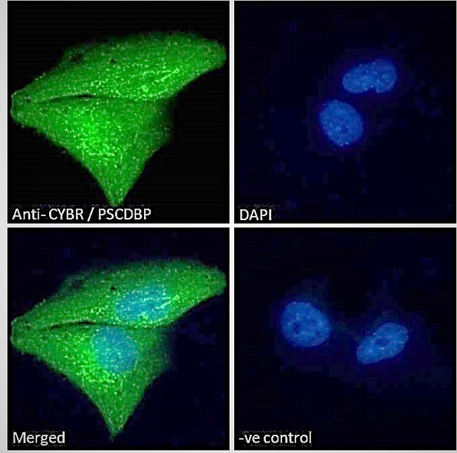 CYTIP Antibody - Goat Anti-CYBR / PSCDBP Antibody Immunofluorescence analysis of paraformaldehyde fixed U251 cells, permeabilized with 0.15% Triton. Primary incubation 1hr (10ug/ml) followed by Alexa Fluor 488 secondary antibody (2ug/ml), showing strong cytoplasmic and weak nuclear staining. The nuclear stain is DAPI (blue). Negative control: Unimmunized goat IgG (10ug/ml) followed by Alexa Fluor 488 secondary antibody (2ug/ml).