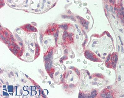 Cytochrome P450 2R1 / CYP2R1 Antibody - Human Placenta: Formalin-Fixed, Paraffin-Embedded (FFPE)