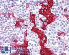 Cytokeratin 10+13 Antibody - Anti-Keratin 10/13 antibody IHC of human tonsil. Immunohistochemistry of formalin-fixed, paraffin-embedded tissue after heat-induced antigen retrieval. Antibody concentration 10 ug/ml.