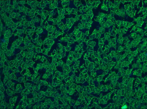 Cytokeratin 5+8 Antibody - Immunofluorescent staining on frozen sections of human liver hepatocytes