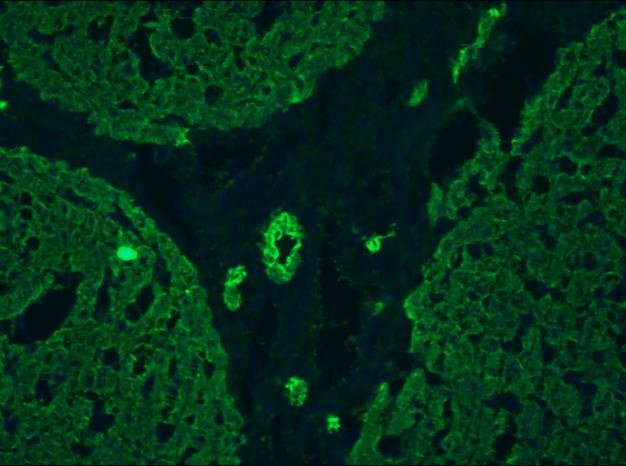 Cytokeratin 5+8 Antibody - Immunofluorescent staining on frozen sections of human liver hepatocytes and bile ducts