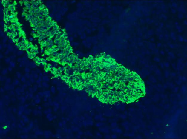 Cytokeratin 5+8 Antibody - Immunofluorescent staining on frozen sections of human urinary bladder epithelium