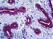 Cytokeratin 8+18+19 Antibody - Anti-Keratin 8/18/19 antibody IHC of human breast. Immunohistochemistry of formalin-fixed, paraffin-embedded tissue after heat-induced antigen retrieval. Antibody dilution 1:100.