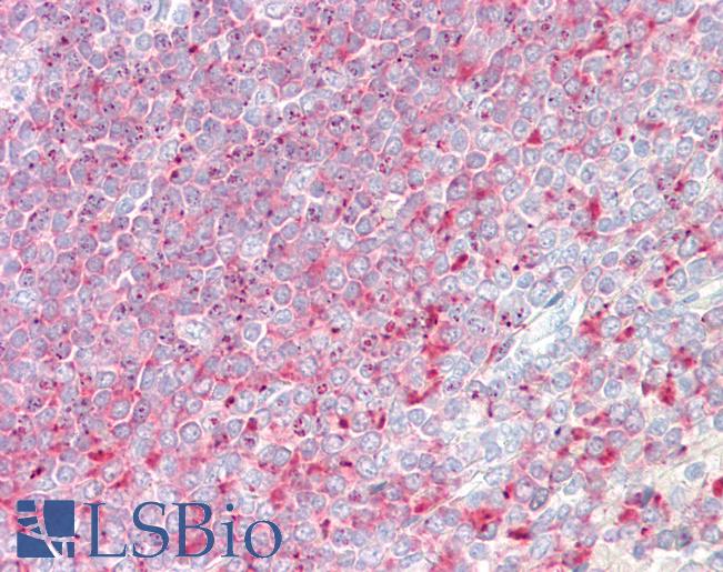 D52 / TPD52 Antibody - Anti-D52 / TPD52 antibody IHC staining of human spleen. Immunohistochemistry of formalin-fixed, paraffin-embedded tissue after heat-induced antigen retrieval.
