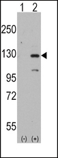 DAAM1 Antibody - Western blot of DAAM1 (arrow) using rabbit polyclonal DAAM1 Antibody(Human N-term). 293 cell lysates (2 ug/lane) either nontransfected (Lane 1) or transiently transfected with the DAAM1 gene (Lane 2) (Origene Technologies).