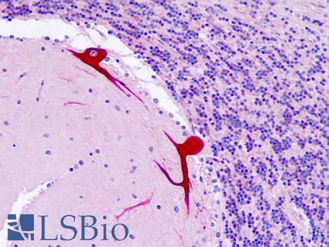 DAB1 Antibody - Anti-DAB1 antibody IHC staining of human brain, cerebellum. Immunohistochemistry of formalin-fixed, paraffin-embedded tissue after heat-induced antigen retrieval.