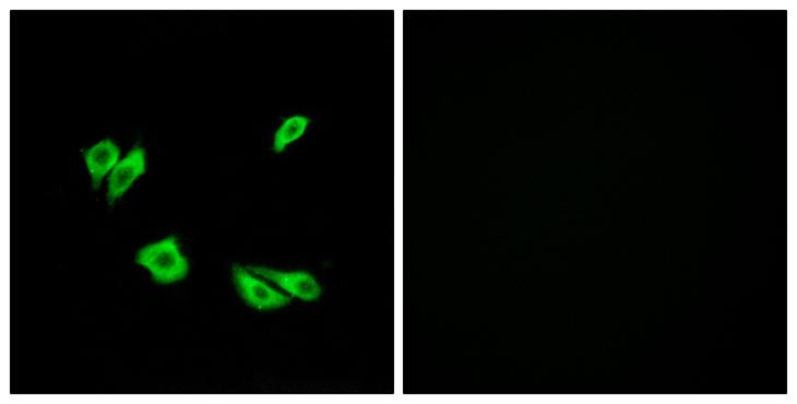 DAB1 Antibody - Immunofluorescence analysis of HepG2 cells, using Dab1 Antibody. The picture on the right is blocked with the synthesized peptide.