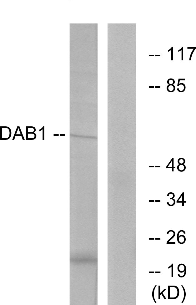 DAB1 Antibody - Western blot analysis of lysates from HeLa cells, using Dab1 Antibody. The lane on the right is blocked with the synthesized peptide.