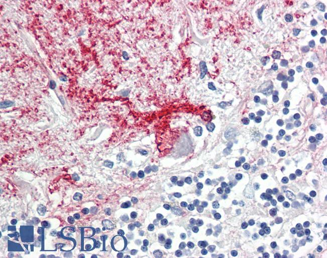 DAB1 Antibody - Anti-DAB1 antibody IHC staining of human brain, cerebellum. Immunohistochemistry of formalin-fixed, paraffin-embedded tissue after heat-induced antigen retrieval.