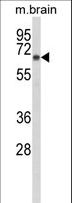 DAB1 Antibody - Western blot of DAB1 Antibody in mouse brain tissue lysates (35 ug/lane). DAB1 (arrow) was detected using the purified antibody.