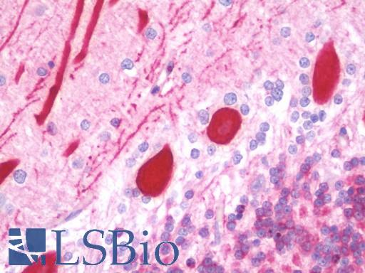 DAB1 Antibody - Anti-DAB1 antibody IHC staining of human brain, cerebellum. Immunohistochemistry of formalin-fixed, paraffin-embedded tissue after heat-induced antigen retrieval. Antibody dilution 1:100.
