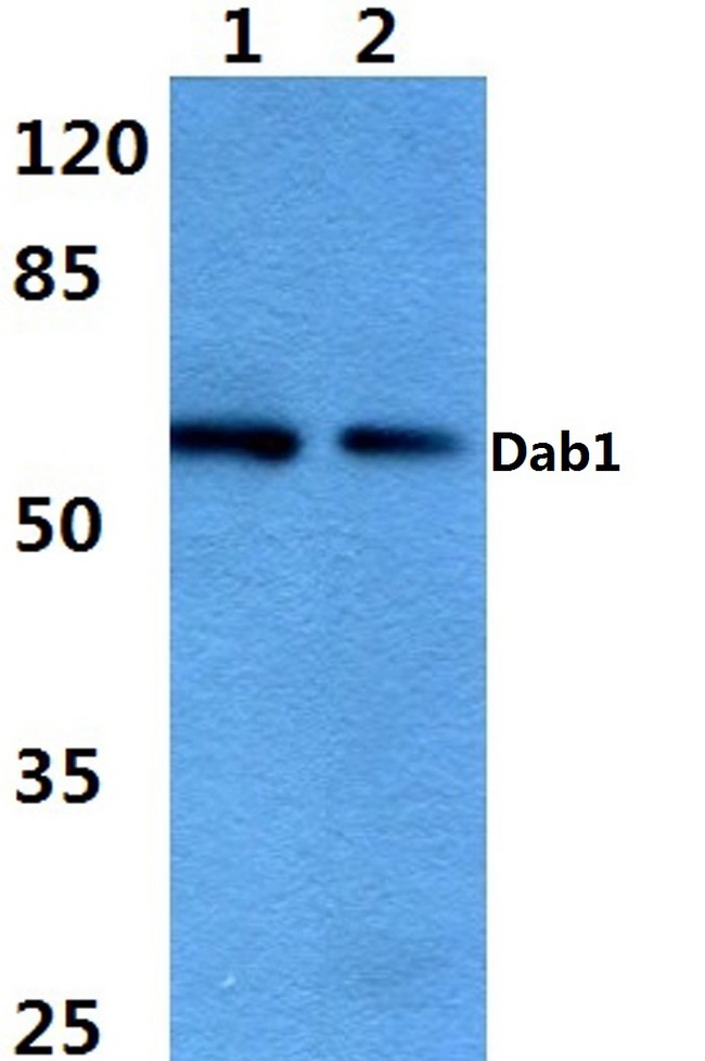 DAB1 Antibody - Western blot analysis of DAB1 pAb at a dilution of 1:500.  Lane 1: HeLa cell lysate.  Lane 2: H9C2 cell lysate.