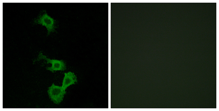 DAB1 Antibody - Immunofluorescence analysis of MCF7 cells, using Dab1 Antibody. The picture on the right is blocked with the synthesized peptide.