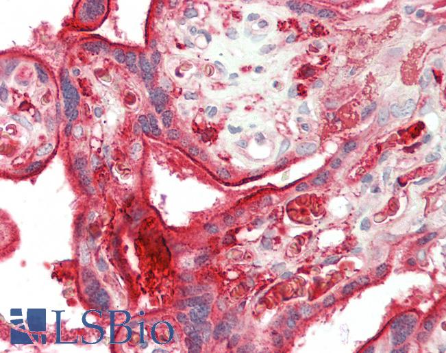 DAB2 Antibody - Human Placenta: Formalin-Fixed, Paraffin-Embedded (FFPE)