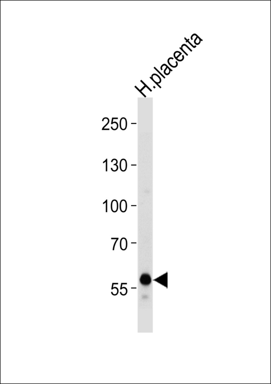 DAB2 Antibody - Western blot of lysate from human placenta tissue lysate, using DAB2 Antibody. Antibody was diluted at 1:1000 at each lane. A goat anti-rabbit IgG H&L (HRP) at 1:5000 dilution was used as the secondary antibody. Lysate at 35ug per lane.