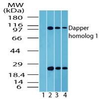DACT1 / DAPPER Antibody - Western blot of Dapper homolog 1inbrain lysate. Lane1 shows pre-immune sera. Lanes 2, 3 and 4 show DACT1 / DAPPER Antibody tested on human brain (1 ug/ml), mouse brain (0.5 ug/ml) and rat brain (0.5 ug/ml) lysate.