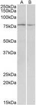 DAG1 / Dystroglycan Antibody - Goat Anti-DAG1 Antibody (0.1µg/ml) staining of Mouse and Rat Skeletal Muscle lysate (35µg protein in RIPA buffer). Detected by chemiluminescencence.