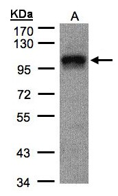 DAP-5 / EIF4G2 Antibody - Sample(30 g of whole cell lysate). A: A431. 7.5% SDS PAGE. EIF4G2 antibody diluted at 1:1000.