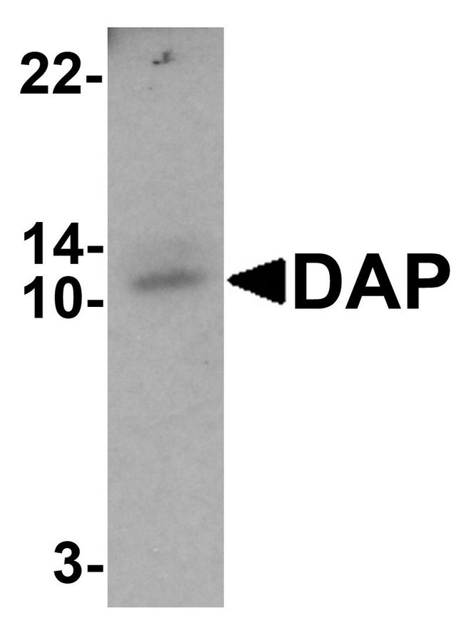 DAP Antibody - Western blot analysis of DAP in human small intestine tissue lysate with DAP antibody at 1 ug/ml.