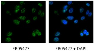 DAP3 Antibody - Death Associated Protein 3 antibody immunofluorescence staining of MCF7 cells with 5ug/ml antibody. Detected with Rabbit anti-goat IgG-Alexafluor488 antibody at 1:1000.