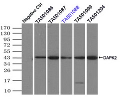 DAPK2 / DAP Kinase 2 Antibody - Immunoprecipitation(IP) of DAPK2 by using monoclonal anti-DAPK2 antibodies (Negative control: IP without adding anti-DAPK2 antibody.). For each experiment, 500ul of DDK tagged DAPK2 overexpression lysates (at 1:5 dilution with HEK293T lysate), 2 ug of anti-DAPK2 antibody and 20ul (0.1 mg) of goat anti-mouse conjugated magnetic beads were mixed and incubated overnight. After extensive wash to remove any non-specific binding, the immuno-precipitated products were analyzed with rabbit anti-DDK polyclonal antibody.