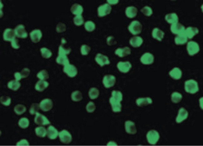 DAPK3 / ZIP Kinase Antibody - Immunofluorescence of ZIPK in Jurkat cells with ZIPK antibody at 10 ug/ml.