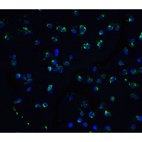 DAPK3 / ZIP Kinase Antibody - Immunofluorescence of ZIPK in Jurkat cells with ZIPK antibody at 5 µg/ml.Green: ZIPK Antibody  Blue: DAPI staining