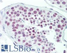 DAT1 / LMO3 Antibody - Anti-DAT1 / LMO3 antibody IHC staining of human testis. Immunohistochemistry of formalin-fixed, paraffin-embedded tissue after heat-induced antigen retrieval. Antibody dilution 1:100.