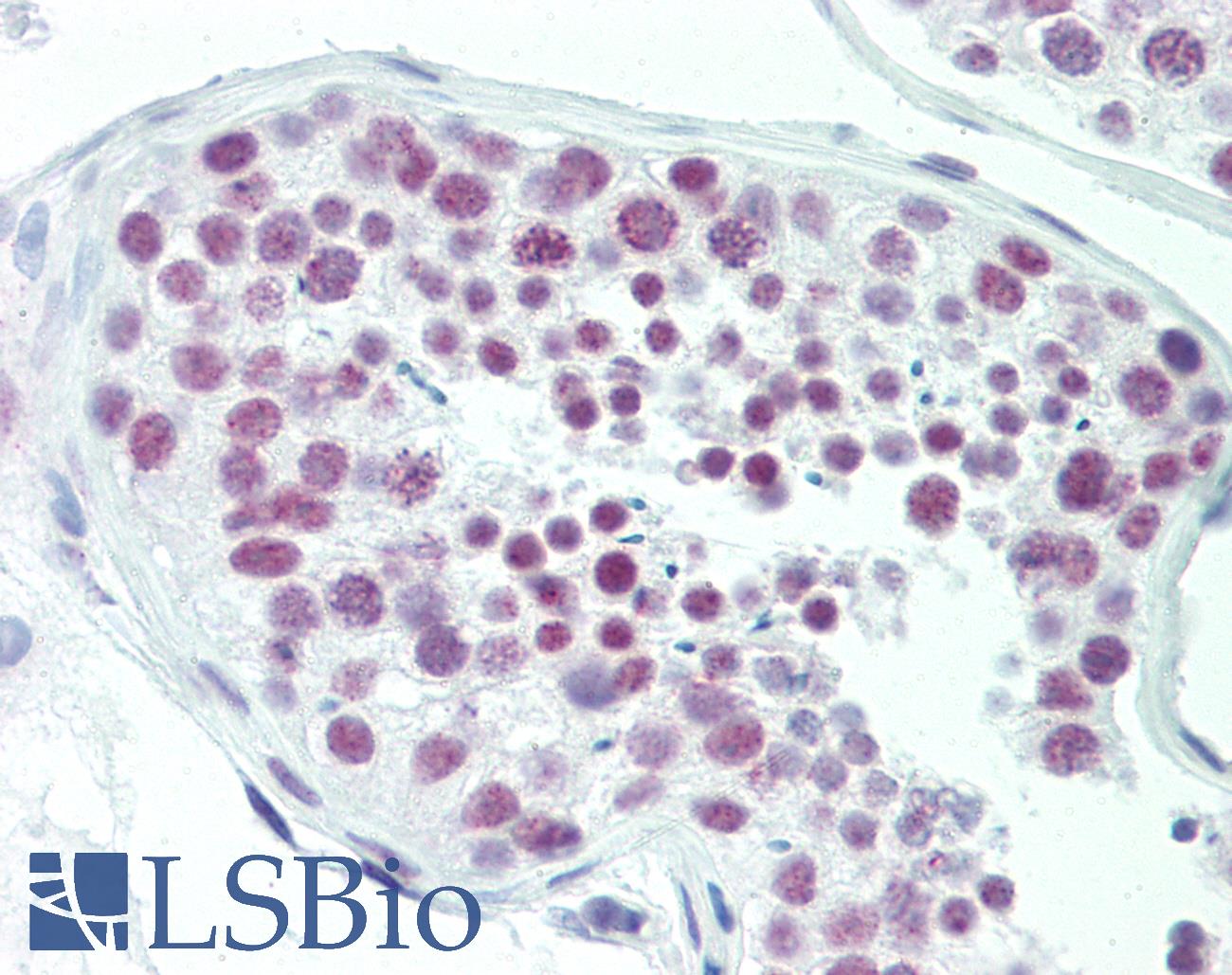 DAT1 / LMO3 Antibody - Anti-DAT1 / LMO3 antibody IHC staining of human testis. Immunohistochemistry of formalin-fixed, paraffin-embedded tissue after heat-induced antigen retrieval. Antibody dilution 1:100.