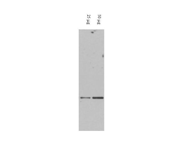 DAXX Antibody - Anti-DAXX Antibody - Western Blot. Western blot of affinity purified anti-DAXX antibody shows detection of DAXX in RWPE-1 cell extracts. The membrane was probed with the primary antibody diluted to 1:200, and further probed with peroxidase conjugated anti-Rabbit IgG at a 1:25000 dilution. Personal Communication, Jie LIU, CCR-NCI, Bethesda, MD.