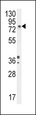 DBH/Dopamine Beta Hydroxylase Antibody - DBH Antibody (N-term P42) western blot of A2058 cell line lysates (35 ug/lane). The DBH antibody detected the DBH protein (arrow).
