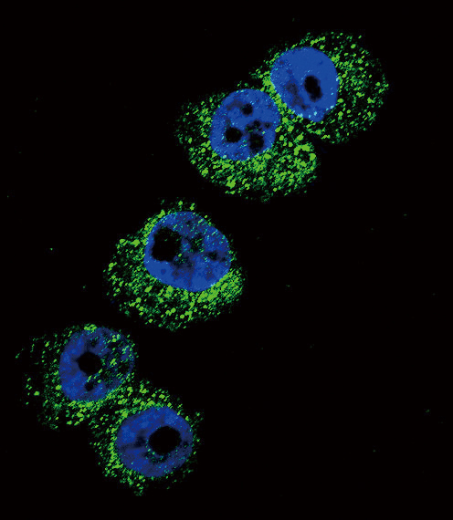 DBH/Dopamine Beta Hydroxylase Antibody - Confocal immunofluorescence of DBH Antibody (N-term P42) with A2058 cell followed by Alexa Fluor 488-conjugated goat anti-rabbit lgG (green). DAPI was used to stain the cell nuclear (blue).