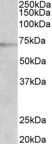 DBH/Dopamine Beta Hydroxylase Antibody - DBH antibody (2 ug/ml) staining of Jurkat lysate (35 ug protein in RIPA buffer). Primary incubation was 1 hour. Detected by chemiluminescence.