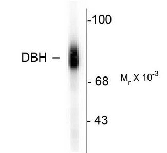 DBH/Dopamine Beta Hydroxylase Antibody - Western blot of human adrenal medulla lysate showing specific immunolabeling of the ~75k DBH protein.
