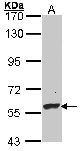 DBH/Dopamine Beta Hydroxylase Antibody - Sample (30 ug of whole cell lysate). A: Hep G2 . 7.5% SDS PAGE. DBH antibody diluted at 1:5000.