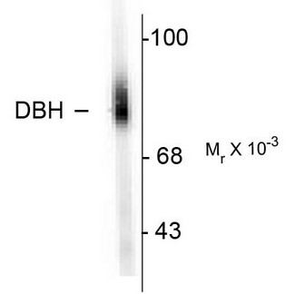 DBH/Dopamine Beta Hydroxylase Antibody - Western blot of human adrenal medulla lysate showing specific immunolabeling of the ~75k DBH protein.