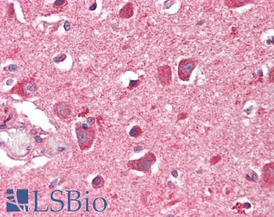DBN1 / Drebrin Antibody - Human Brain, Cortex: Formalin-Fixed, Paraffin-Embedded (FFPE)